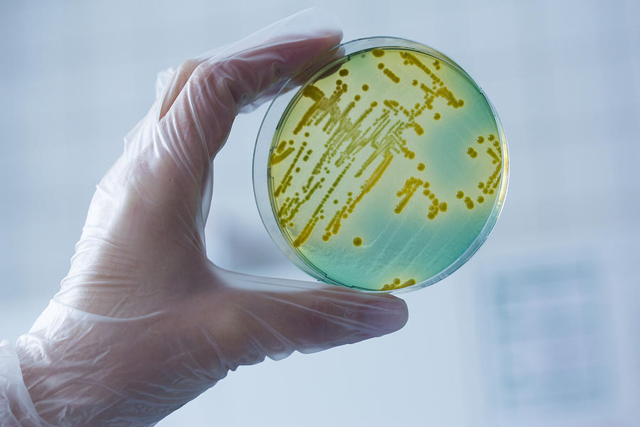 Bacteria growing in petri dish in lab Photograph by Cultura RM Exclusive/Sigrid Gombert