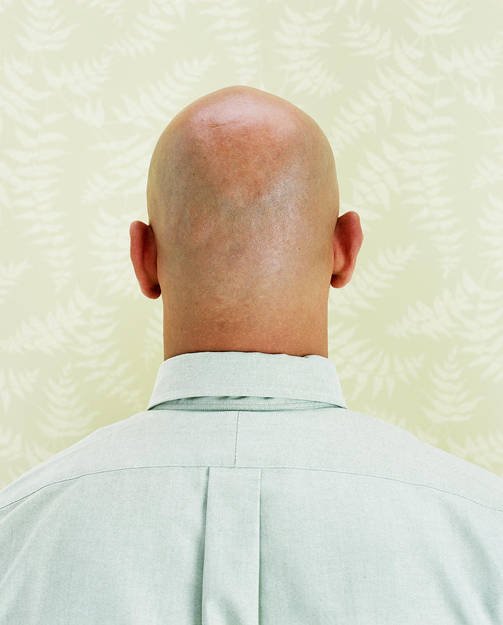 Bald man, close-up, rear view Photograph by Digital Vision