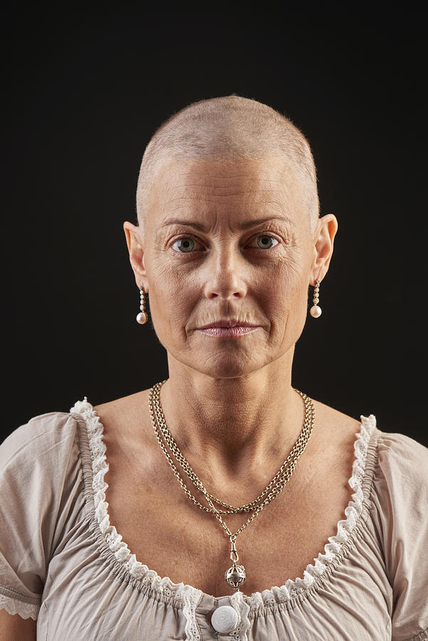 Bald woman in chemotherapy fighting cancer Photograph by Westersoe