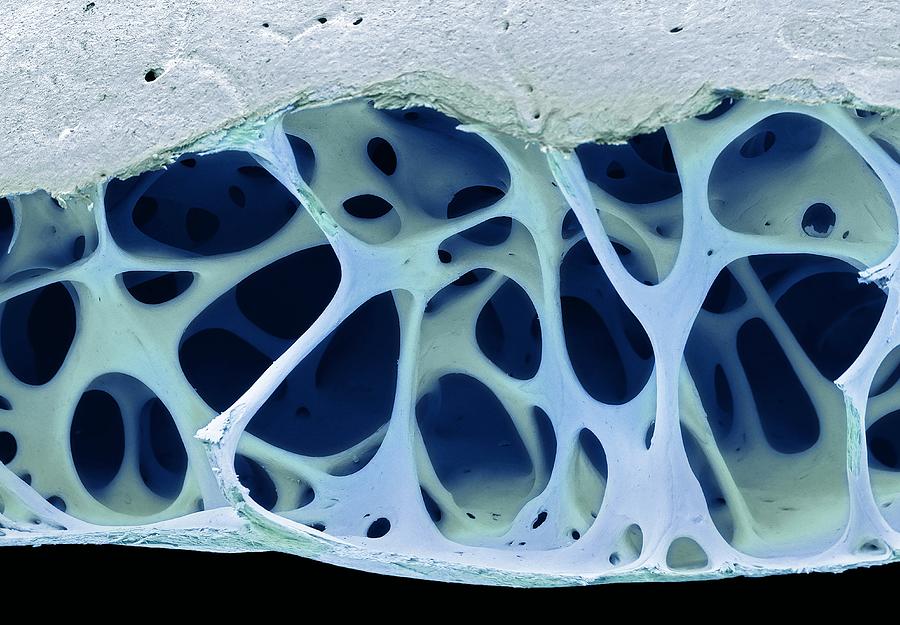 Bird bone tissue, SEM Drawing by Steve Gschmeissner/science Photo Library