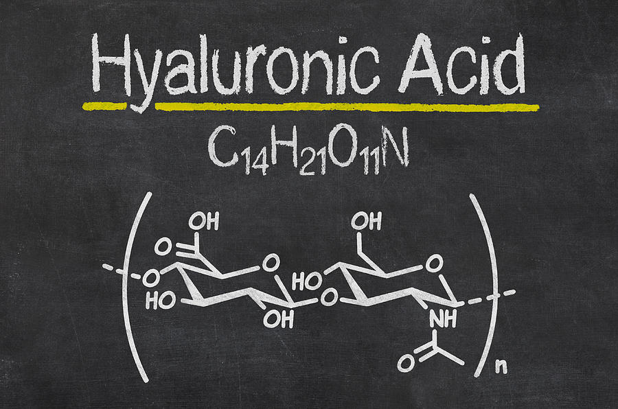 Blackboard with the chemical formula of hyaluronic acid Photograph by Zerbor