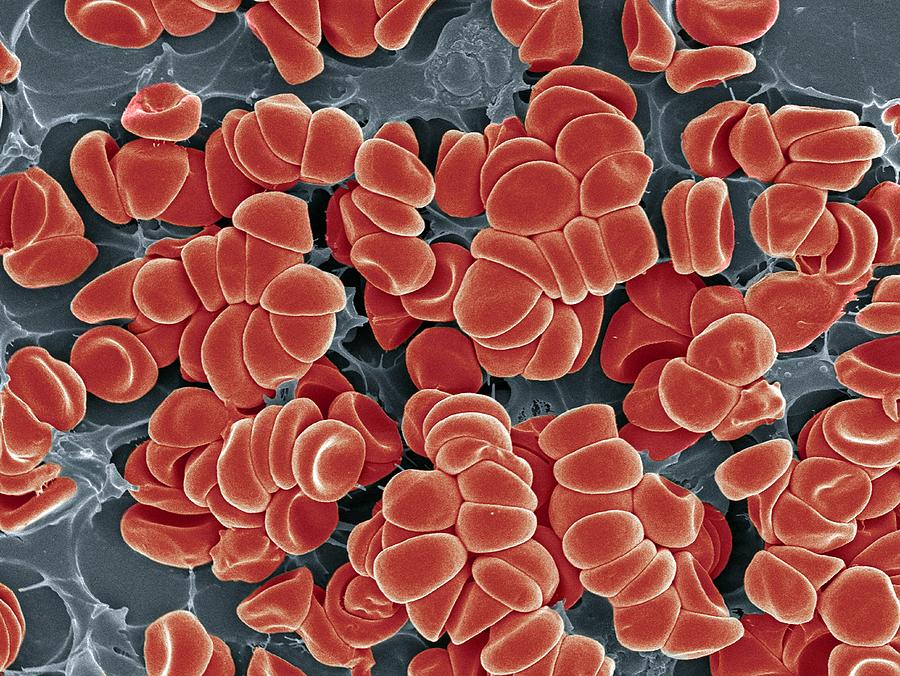 Blood clot Photograph by Science Photo Library - STEVE GSCHMEISSNER.