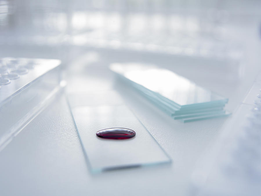 Blood droplet on microscope slide Photograph by Adam Gault