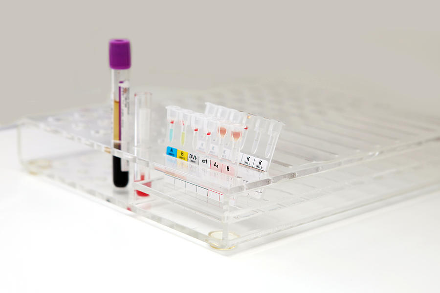 Blood samples in test tube in a blood bank Photograph by Choja