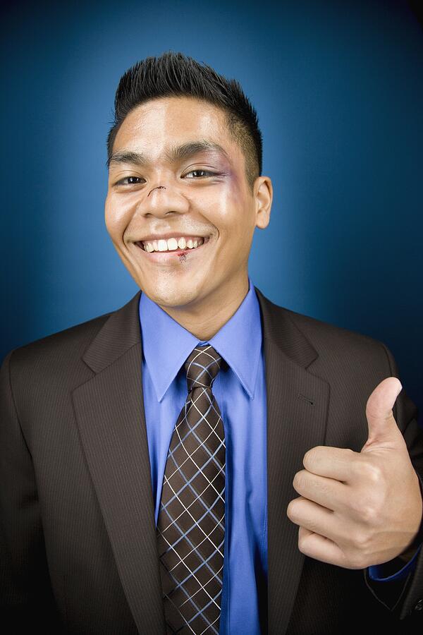 Bruised Asian businessman smiling and giving thumbs up Photograph by John M Lund Photography Inc