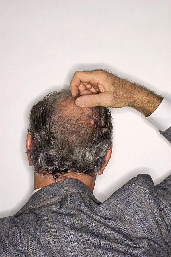 Businessman scratching head Photograph by Jupiterimages