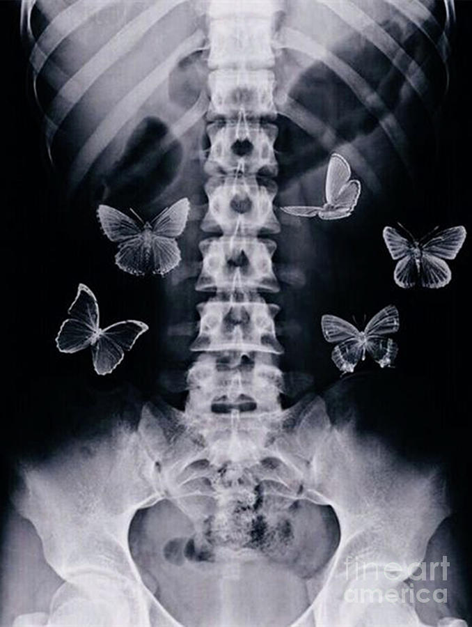 Butterflies X-Ray Digital Art by Natasha Guzman - Fine Art America