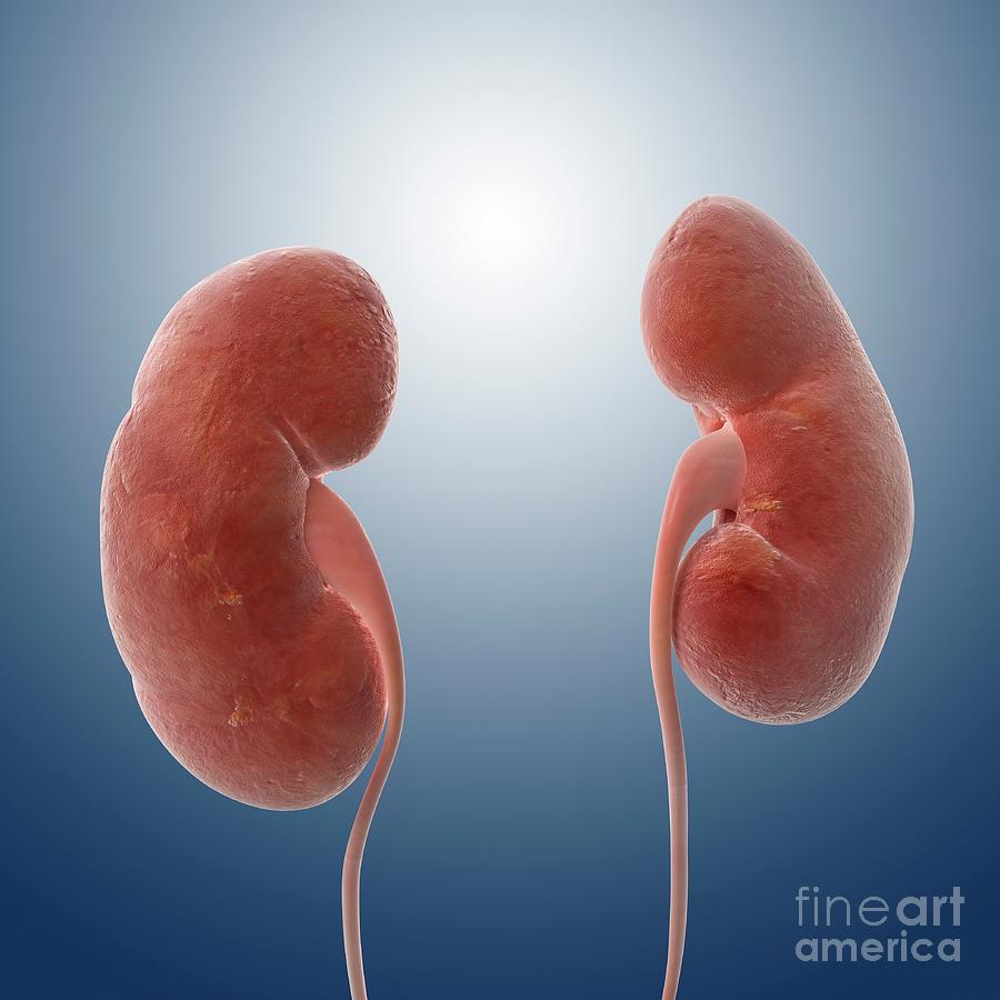 Kidney Photograph - C014/0396 by Science Photo Library Kidney Photograph - C014/0396 by Science Photo Library