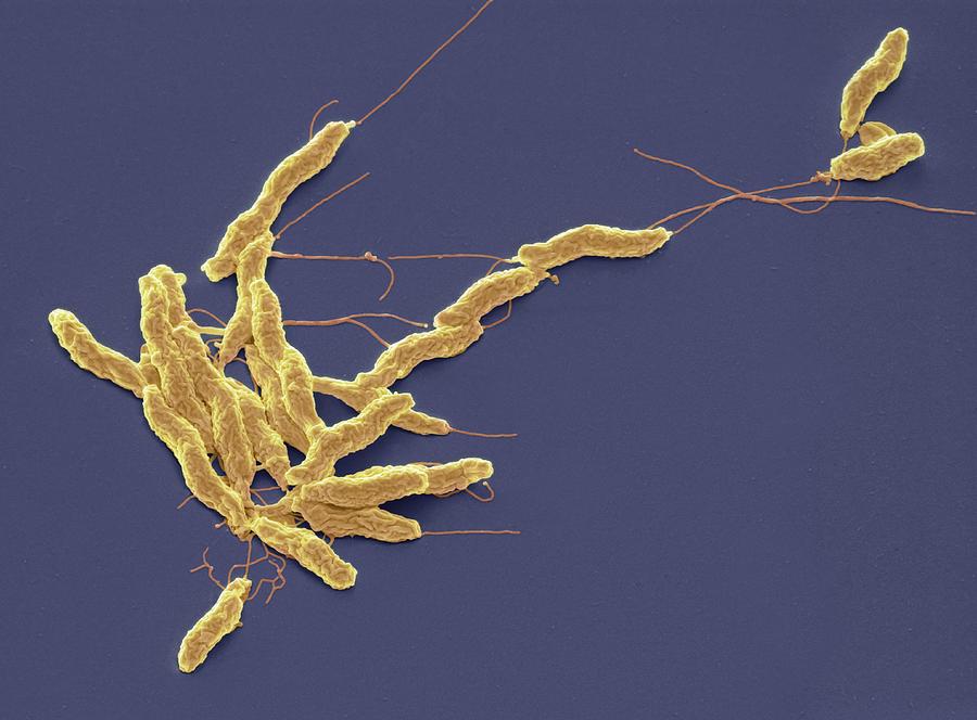 Campylobacter jejuni bacteria, SEM Photograph by Steve Gschmeissner/science Photo Library