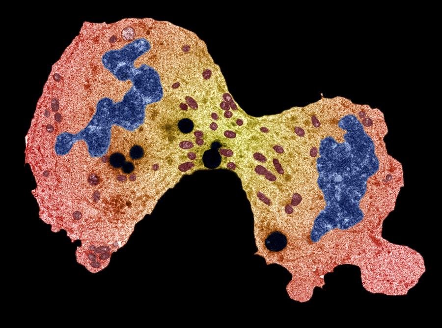 Cancer cell division Drawing by Science Photo Library - STEVE GSCHMEISSNER.