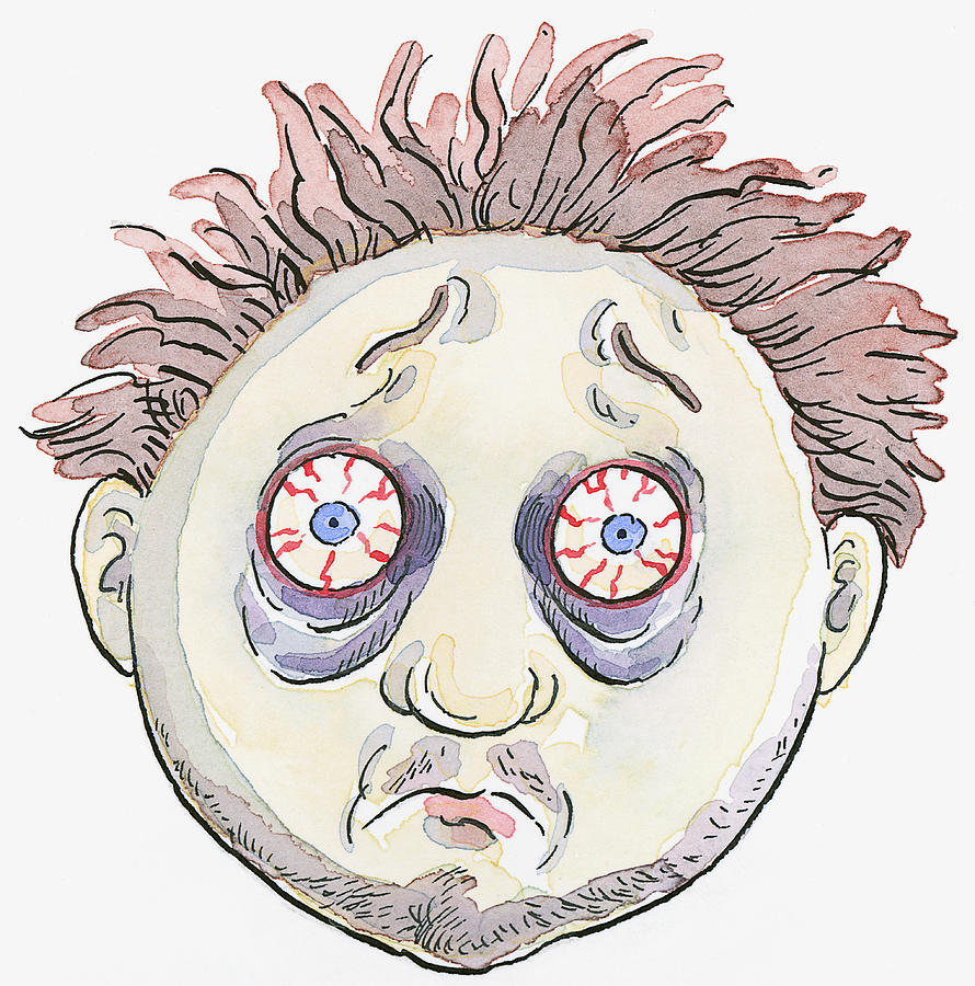 Cartoon of man with messy hair, bags below bloodshot eyes, and stubble on face and chin Drawing by Dorling Kindersley