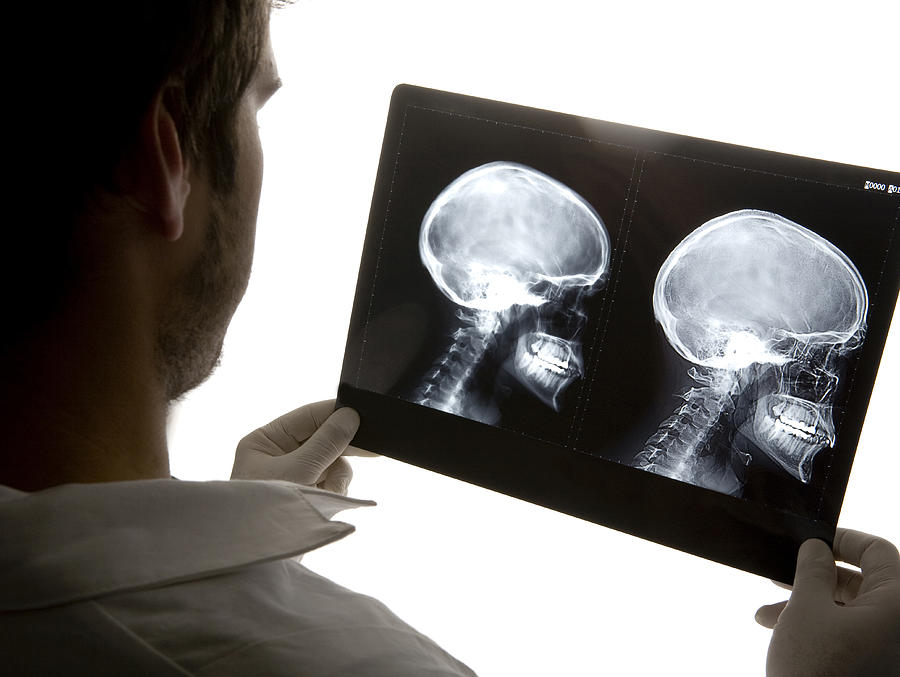 Caucasian doctor examining x-rays in hospital Photograph by Walter Zerla
