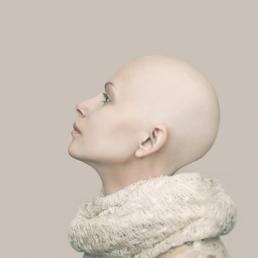 Caucasian woman with bald head Photograph by Vladimir Serov