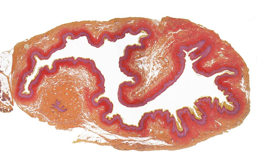 Cervix, LM Photograph by Steve Gschmeissner/science Photo Library