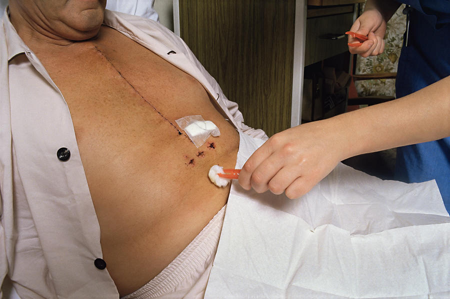 Cleaning wounds after surgery Photograph by Image Source