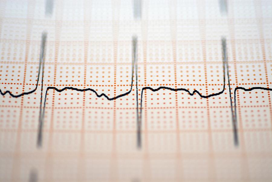 Close-up of an ECG report Photograph by Glowimages