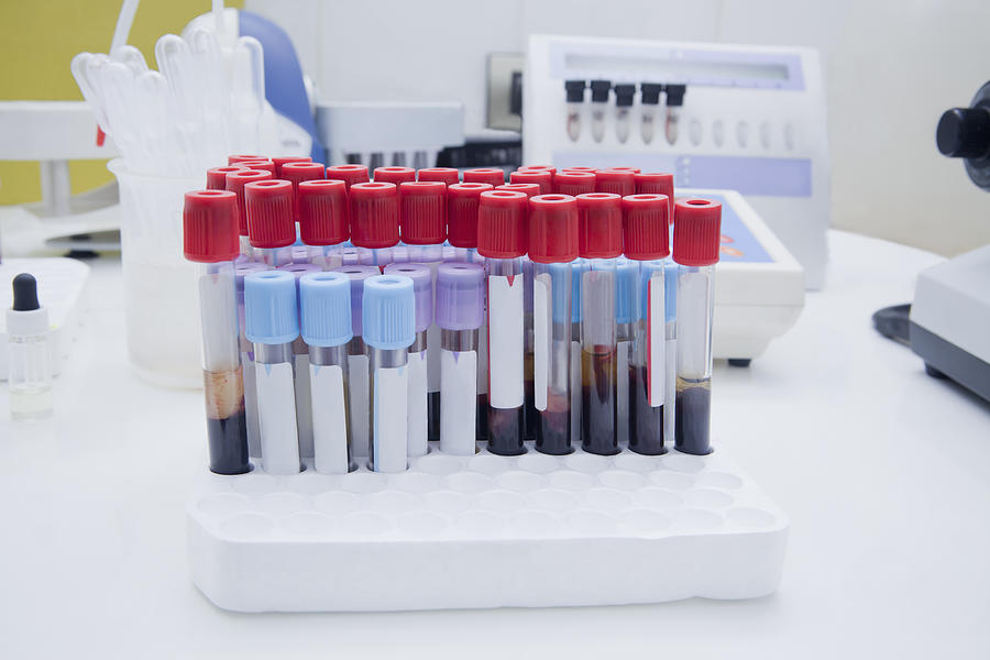 Close up of blood samples in test tube rack in laboratory Photograph by REB Images