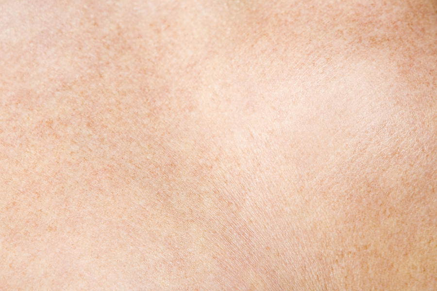 Close up of skin Photograph by Image Source