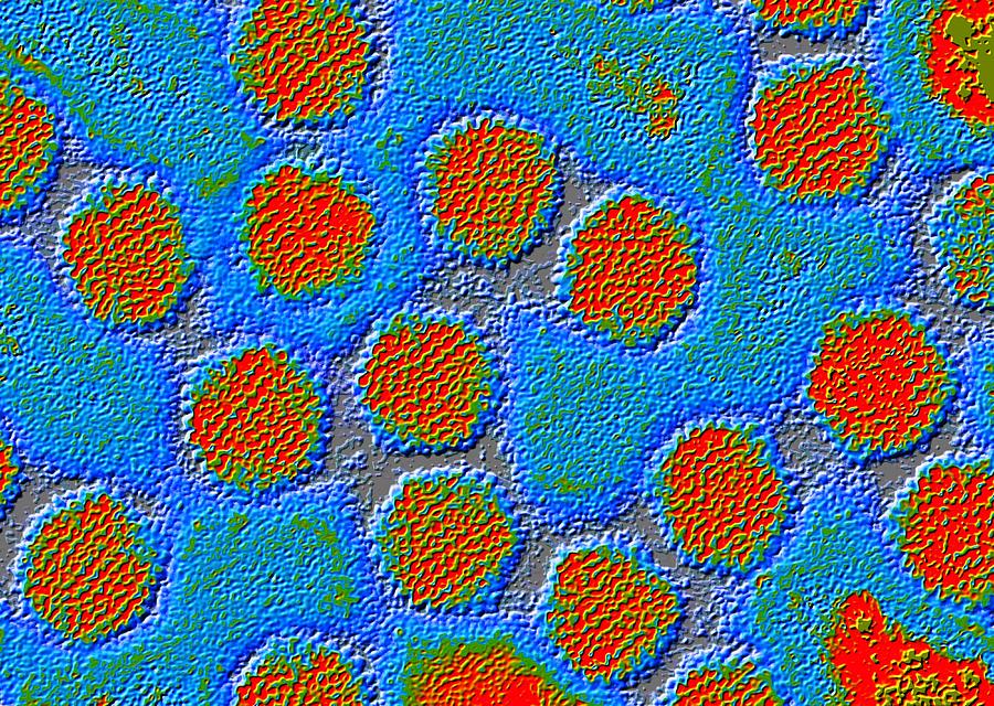 Colored transmission electron micrograph (TEM) of adenovirus particles Photograph by Pasieka/spl