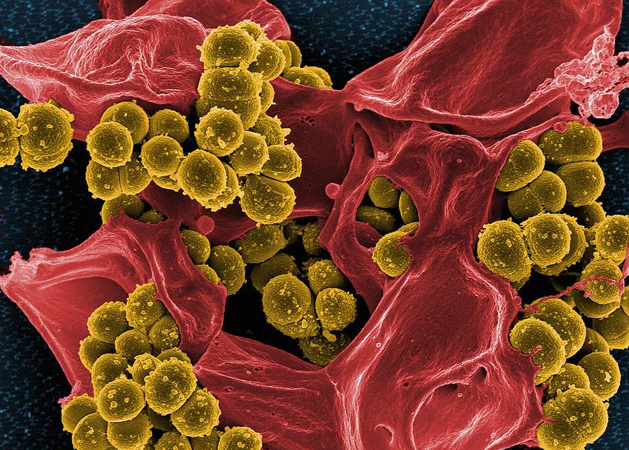 Colorized SEM of methicillin-resistant Staphylococcus aureus (MRSA) bacteria in the process of being phagocytized by a human neutrophil white blood cell Photograph by Callista Images