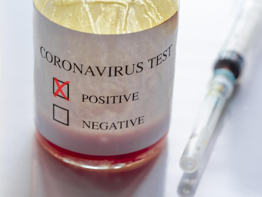 Coronavirus Positive Blood Test And Syringe Photograph by Javier Zayas Photography