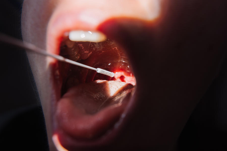 Cotton swab in open mouth for rapid testing for covid-19. Photograph by Guido Mieth