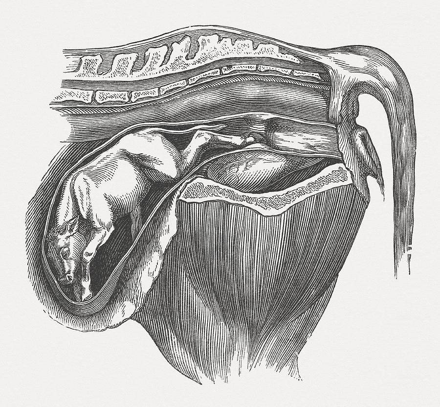 Cow fetus in wrong position, wood engraving, published in 1883 Drawing by Zu_09