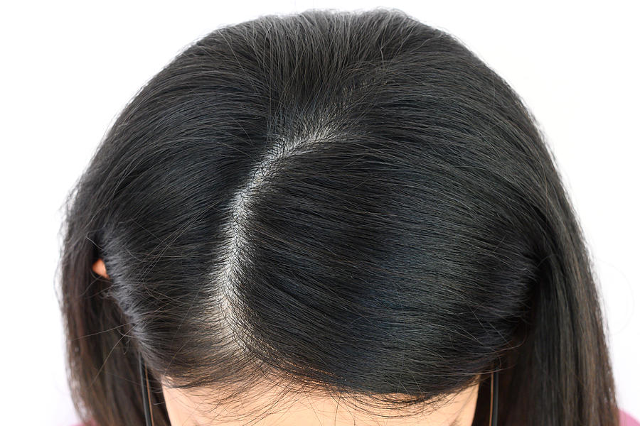 Cropped view of woman tops head with part of her thin hair, she had hair loss problem. Photograph by Boyloso