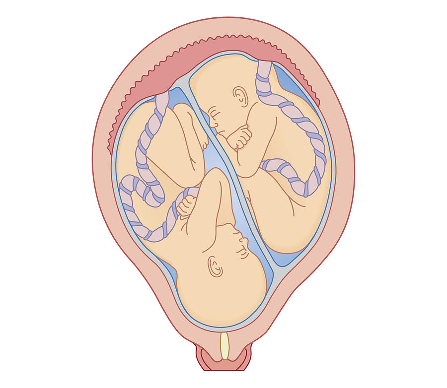 Cross section biomedical illustration of identical twins in uterus sharing placenta Drawing by Dorling Kindersley