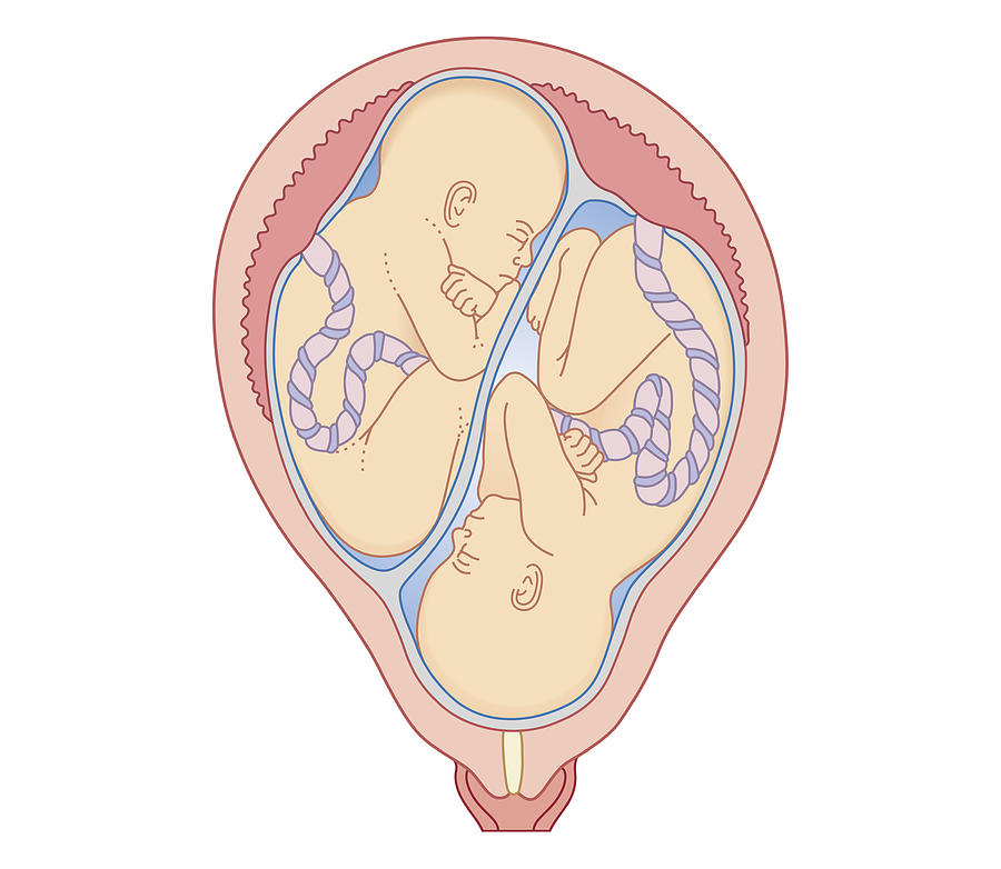 Cross section biomedical illustration of non identical twins in uterus with separate placentas Drawing by Dorling Kindersley