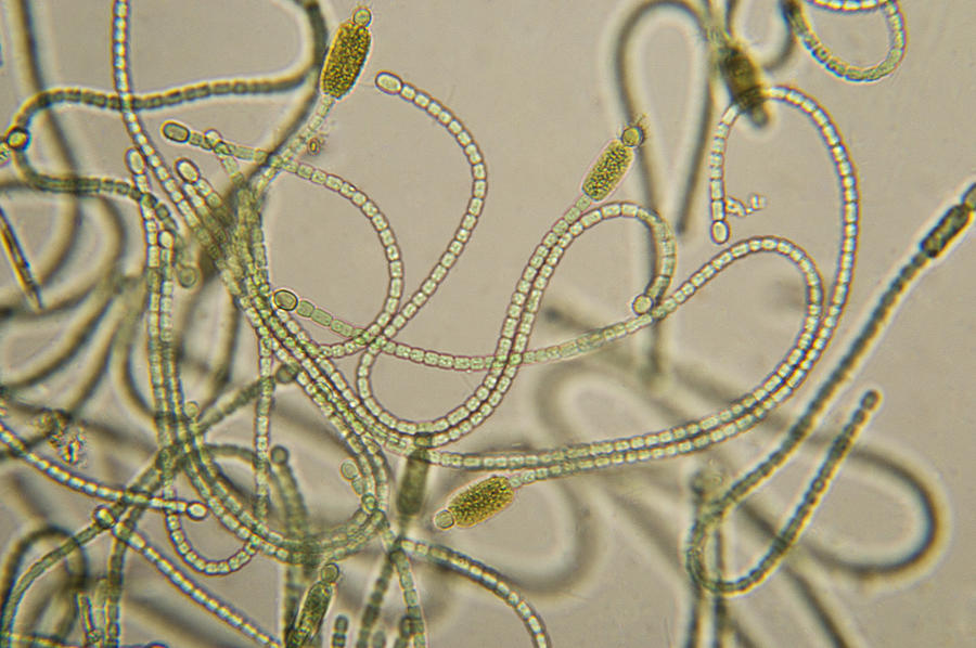 Cyanobacteria Micrograph Photograph by NNehring