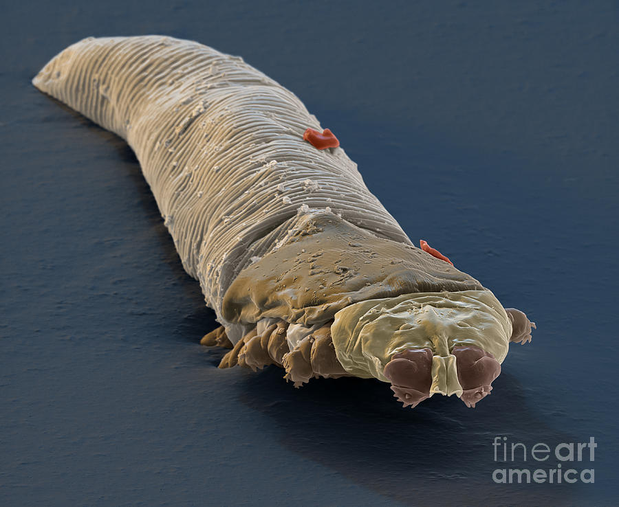 Demodex folliculorum Photograph by Eye of Science