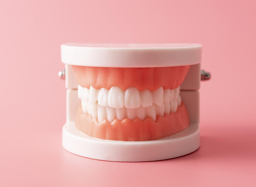Dental Model Photograph by Huizeng Hu