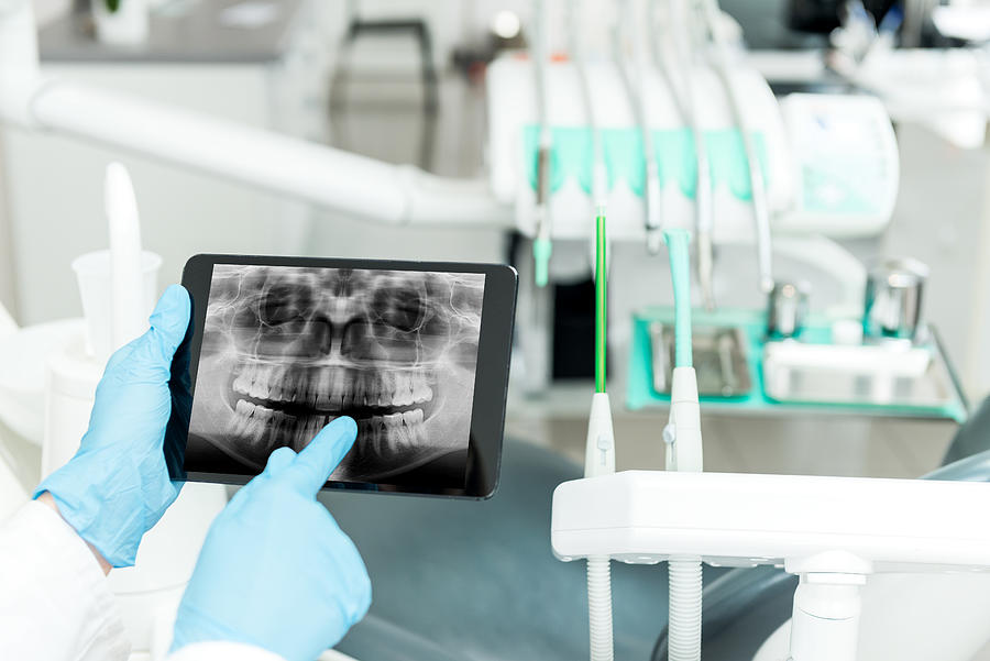Dental radiogram on tablet Photograph by Yoh4nn