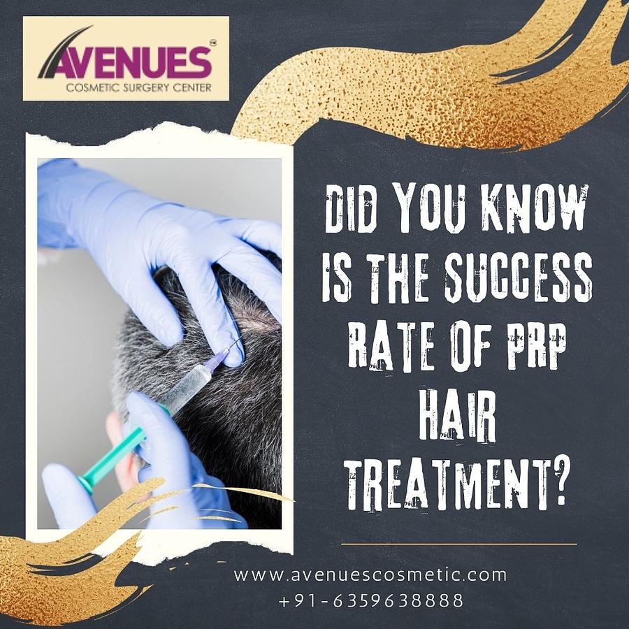 Did You Know Is The Success Rate Of Prp Hair Treatment Photograph By Aneues Hairs 5806