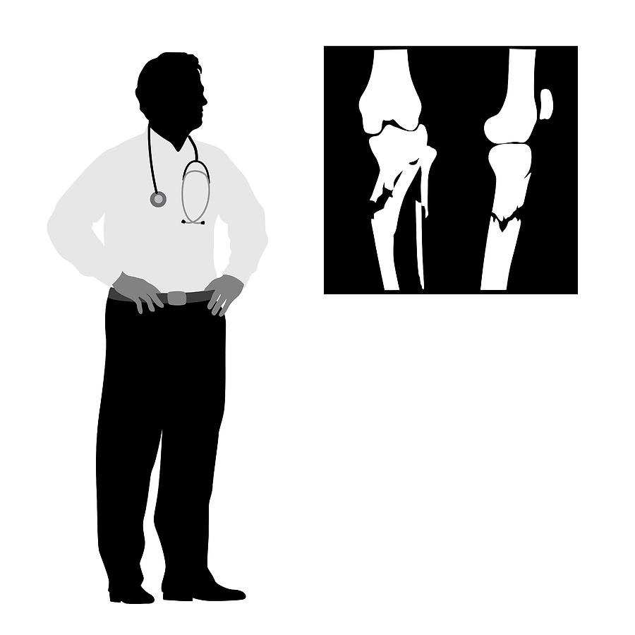 Doctor Medical Advice Fracture Drawing by A-Digit
