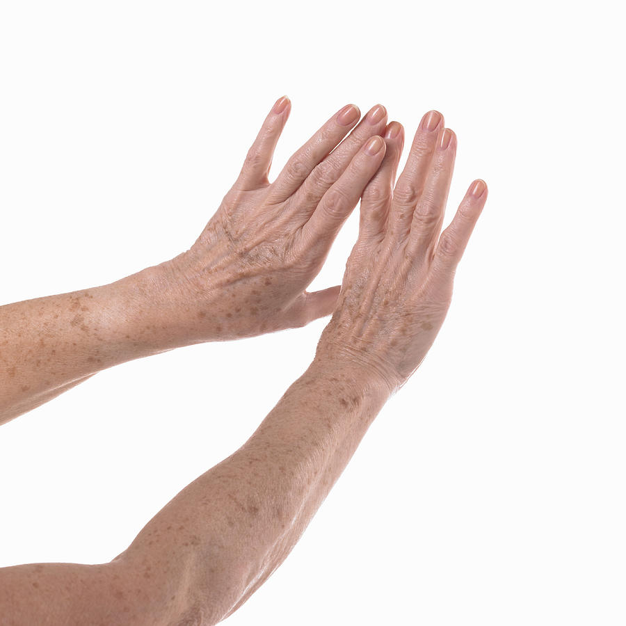 Elderly hands and arms. Photograph by Dougal Waters