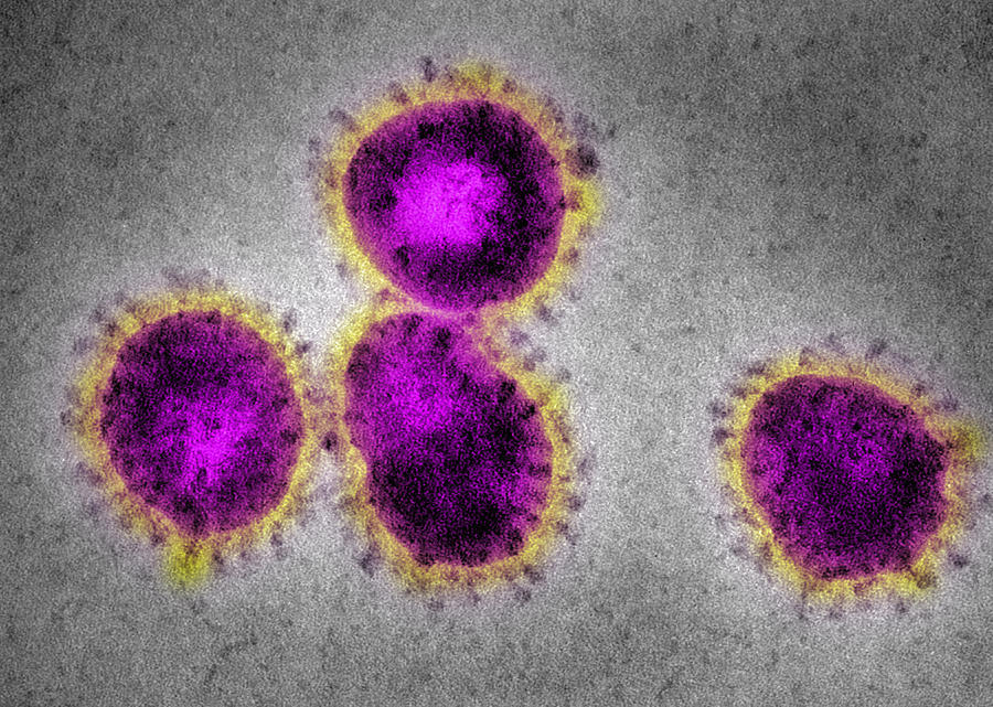 EM Coronavirus, causing SARS Photograph by Callista Images