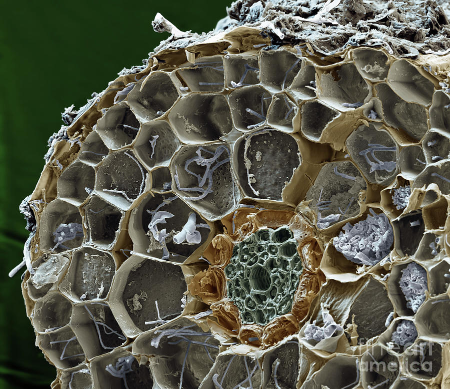 Endomycorrhiza SEM Photograph by Eye of Science