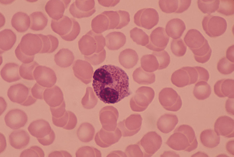 Eosinophil (wbc) Bilobed Nucleus & Reddish Cytoplas - Mic Granules. 400x Photograph by Ed Reschke