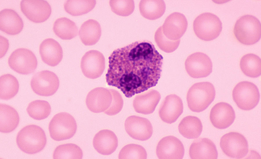 Eosinphil, white blood cell, human blood, (Magnification x400) Showing bilobed nucleus, and large cytoplasmic granules. Photograph by Ed Reschke