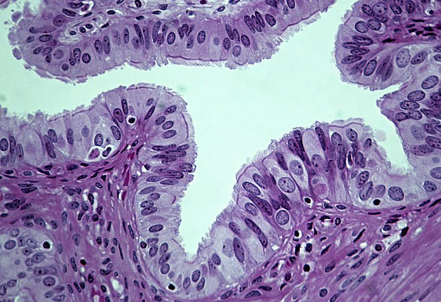 FALLOPIAN (OR UTERINE) TUBE. CILIATED COLUMNAR EPITHELIUM, 100X.  Shows the lumen and the ciliated columnar epithelial cells that line the uterine tube. Photograph by Ed Reschke