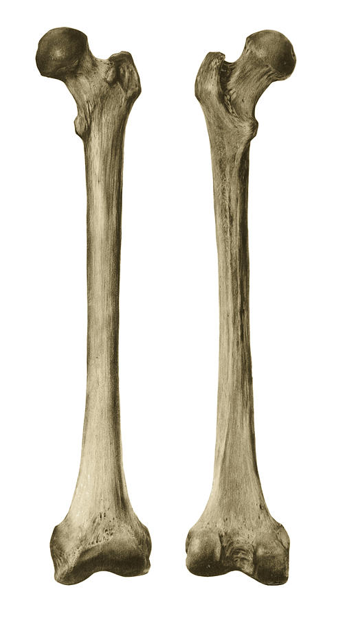 Femur or Thigh Bone Drawing by Russell Kightley