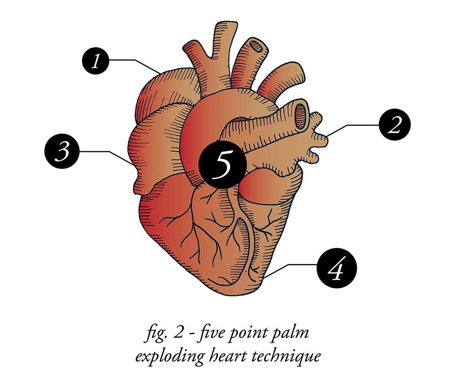 5 Point Exploding Heart Technique