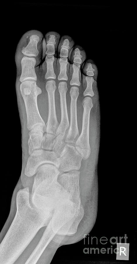 Foot x-ray n5 Photograph by Guy Viner