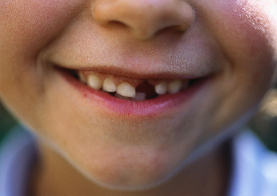 Gap-toothed smile Photograph by Laurence Mouton