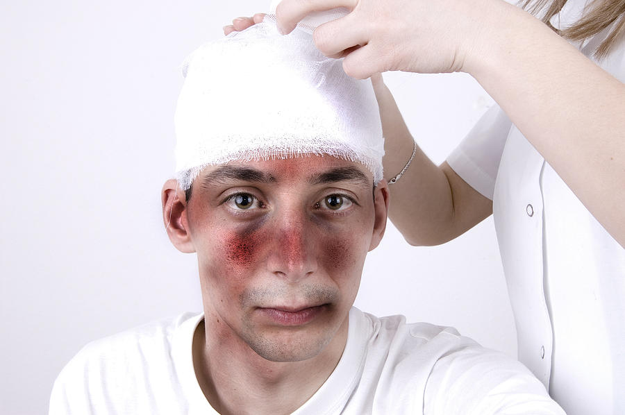 Head injury suffering Photograph by Stock_colors