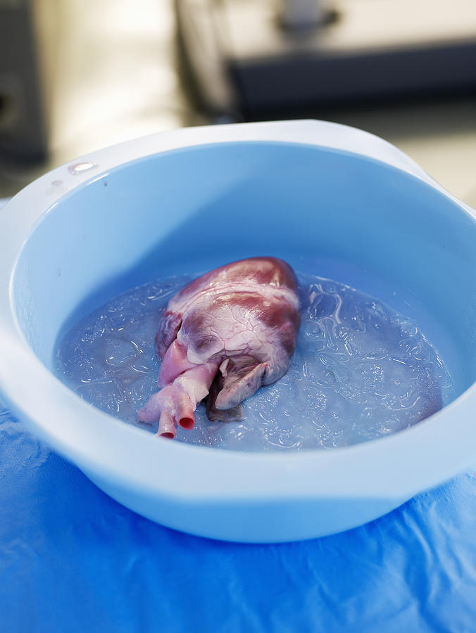 Heart in basin filled with ice in operating room Photograph by Thomas Barwick