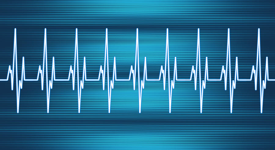 Heart Rate Line Photograph by Artpartner-images