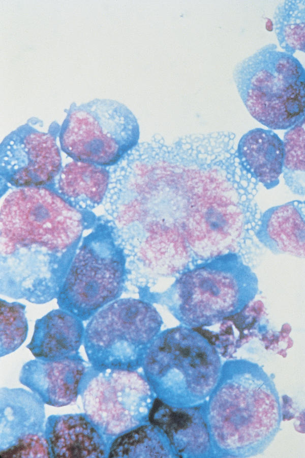HIV-infected T-cells under high magnification Photograph by Comstock
